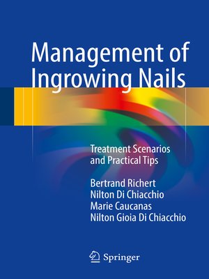 cover image of Management of Ingrowing Nails